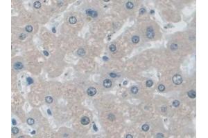Immunohistochemistry (IHC) image for anti-Insulin-Degrading Enzyme (IDE) (AA 753-973) antibody (ABIN7434305)