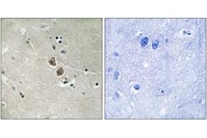 Immunohistochemistry analysis of paraffin-embedded human brain tissue, using NPTN Antibody. (NPTN 抗体  (AA 106-155))