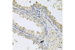 Immunohistochemistry of paraffin-embedded human prostate using PPIC antibody at dilution of 1:100 (x40 lens). (PPIC 抗体)