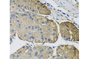Immunohistochemistry of paraffin-embedded Human stomach using THBS2 Polyclonal Antibody at dilution of 1:100 (40x lens). (Thrombospondin 2 抗体)