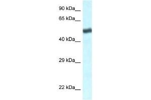 Western Blot showing TBL1XR1 antibody used at a concentration of 1 ug/ml against Jurkat Cell Lysate (TBL1XR1 抗体  (C-Term))