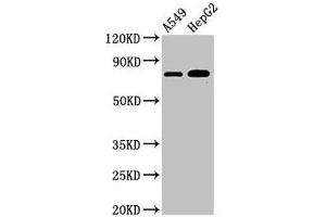 Western Blot Positive WB detected in: A549 whole cell lysate, HepG2 whole cell lysate All lanes: TBC1D15 antibody at 3 μg/mL Secondary Goat polyclonal to rabbit IgG at 1/50000 dilution Predicted band size: 80, 78, 79 kDa Observed band size: 80 kDa