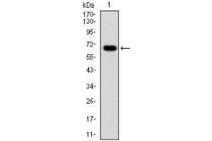Western blot analysis using G6PD mAb against human G6PD (AA: 275-515) recombinant protein. (Glucose-6-Phosphate Dehydrogenase 抗体)