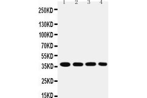 Anti-MTCO1 antibody, Western blotting Lane 1: SMMC Cell Lysate Lane 2: MCF-7 Cell Lysate Lane 3: RAJI Cell Lysate Lane 4: SW620 Cell Lysate (COX1 抗体  (C-Term))