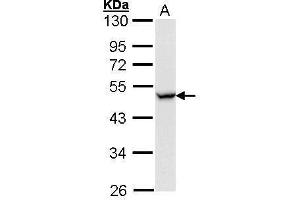 WB Image Sample (30 ug of whole cell lysate) A: Hela 10% SDS PAGE antibody diluted at 1:1000 (CCR8 抗体  (Center))