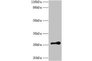 Western blot All lanes: RAB3C antibody at 2 μg/mL + Mouse brain tissue Secondary Goat polyclonal to rabbit IgG at 1/10000 dilution Predicted band size: 26 kDa Observed band size: 26 kDa (Rab3c 抗体  (AA 1-227))