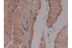 Detection of GLUD1 in Mouse Skeletal muscle Tissue using Polyclonal Antibody to Glutamate Dehydrogenase 1 (GLUD1) (GLUD1 抗体  (AA 65-273))