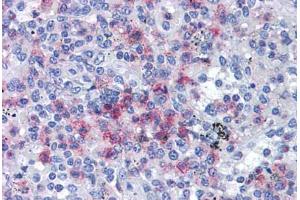 Human Spleen: Formalin-Fixed, Paraffin-Embedded (FFPE) (SPI1 抗体  (AA 1-122))