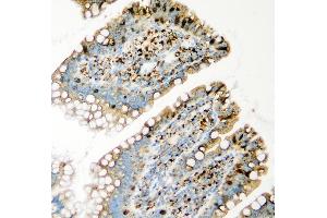 IHC analysis of GLB1 using anti-GLB1 antibody (ABIN7599649). (GLB1 抗体  (AA 103-646))