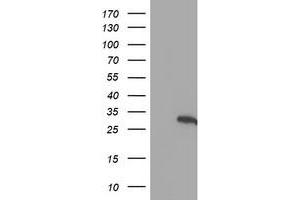 Western Blotting (WB) image for anti-Hes Family bHLH Transcription Factor 1 (HES1) antibody (ABIN1498636) (HES1 抗体)