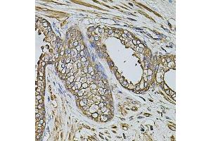 Immunohistochemistry (Paraffin-embedded Sections) (IHC (p)) image for anti-Coproporphyrinogen Oxidase (CPOX) (AA 111-454) antibody (ABIN1679346)