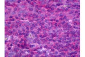 anti-Tumor Necrosis Factor Receptor Superfamily, Member 18 (TNFRSF18) (AA 26-115) antibody