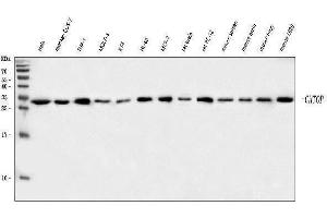 Western blot analysis of C1orf77/FOP/CHTOP using anti-C1orf77/FOP/CHTOP antibody (ABIN7603201). (CHTOP 抗体  (N-Term))