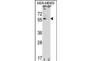 Western blot analysis of TOX3 Antibody (Center) Pab (ABIN651009 and ABIN2840037) pre-incubated without(lane 1) and with(lane 2) blocking peptide in MDA-M cell line lysate. (TOX3 抗体  (AA 214-242))