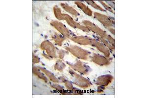 LMD Antibody (N-term) (ABIN657125 and ABIN2846269) immunohistochemistry analysis in formalin fixed and raffin embedded human skeletal muscle followed by peroxidase conjugation of the secondary antibody and DAB staining. (PALMD 抗体  (N-Term))