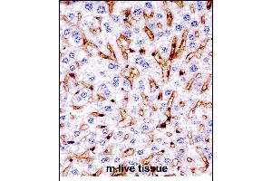 Immunohistochemistry (Paraffin-embedded Sections) (IHC (p)) image for anti-Mitogen-Activated Protein Kinase 11 (MAPK11) (AA 1-30), (N-Term) antibody (ABIN657841)