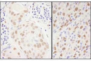 Immunohistochemistry (IHC) image for anti-Sp1 Transcription Factor (SP1) (AA 700-740) antibody (ABIN7454591)