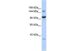 WB Suggested Anti-ZBTB40 Antibody Titration:  0. (ZBTB40 抗体  (Middle Region))