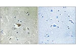 Immunohistochemistry analysis of paraffin-embedded human brain tissue, using CCR5 (Ab-336) Antibody. (CCR5 抗体  (AA 292-341))