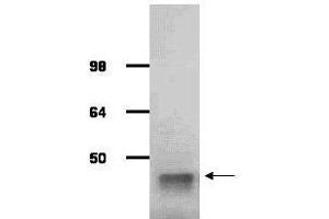 Image no. 1 for anti-Aldolase A, Fructose-Bisphosphate (ALDOA) antibody (ABIN799723) (ALDOA 抗体)