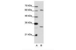 Image no. 2 for anti-AU RNA Binding Protein/enoyl-CoA Hydratase (AUH) (AA 228-277) antibody (ABIN6736199) (AUH 抗体  (AA 228-277))