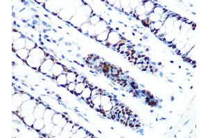 Immunohistochemistry of paraffin-embedded human colon using MCM5 Rabbit mAb (ABIN7268543) at dilution of 1:100 (40x lens). (MCM5 抗体)