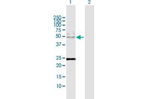 Western Blot analysis of KRT8 expression in transfected 293T cell line by KRT8 MaxPab polyclonal antibody. (KRT8 抗体  (AA 1-483))