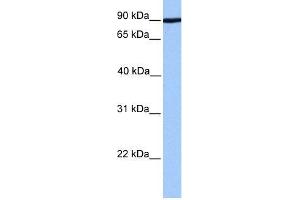 Human 721_B; WB Suggested Anti-ADAM2 Antibody Titration: 0. (ADAM2 抗体  (Middle Region))