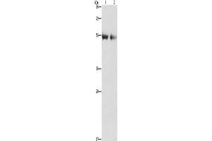Western Blotting (WB) image for anti-Angiopoietin 4 (ANGPT4) antibody (ABIN2829843) (Angiopoietin 4 抗体)