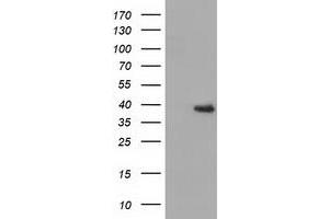 Western Blotting (WB) image for anti-3-hydroxyisobutyryl-CoA Hydrolase (HIBCH) antibody (ABIN1498654) (HIBCH 抗体)