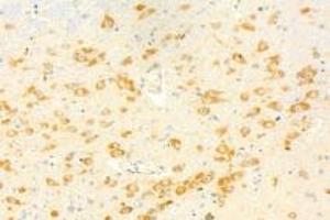 Immunohistochemistry analysis of paraffin-embedded mouse brain using,KPNB1 (ABIN7074398) at dilution of 1: 1000 (KPNB1 抗体)