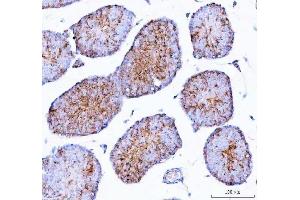 IHC analysis of Epigen using anti-Epigen antibody (ABIN5518911).