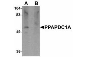 Image no. 1 for anti-Phosphatidic Acid Phosphatase Type 2 Domain Containing 1A (PPAPDC1A) (C-Term) antibody (ABIN478207) (PPAPDC1A 抗体  (C-Term))