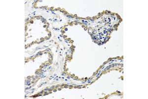 Immunohistochemistry of paraffin-embedded human prostate using COLEC11 antibody at dilution of 1:100 (40x lens). (COLEC11 抗体)