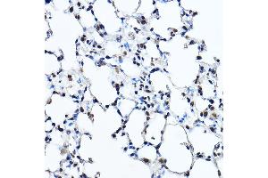 Immunohistochemistry of paraffin-embedded mouse lung using Twist Rabbit pAb (ABIN6133951, ABIN6149713, ABIN6149716 and ABIN6220170) at dilution of 1:200 (40x lens). (TWIST1 抗体  (AA 1-100))