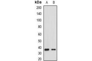 Western blot analysis of HLA-DRA expression in Raji (A), Jurkat (B) whole cell lysates. (HLA-DRA 抗体)