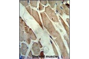 Formalin-fixed and paraffin-embedded human skeletal muscle reacted with the primary antibody, which was peroxidase-conjugated to the secondary antibody, followed by AEC staining. (CKM 抗体  (C-Term))