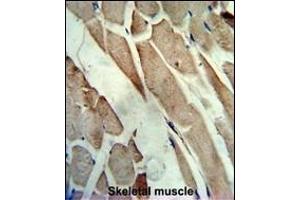 Formalin-fixed and paraffin-embedded human skeletal muscle reacted with the primary antibody, which was peroxidase-conjugated to the secondary antibody, followed by AEC staining. (CKM 抗体  (C-Term))