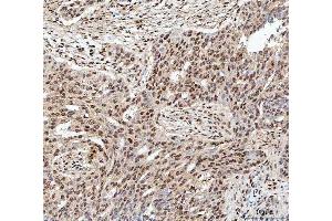 IHC analysis of SDE2 using anti-SDE2 antibody (ABIN7599603). (C1orf55 抗体  (AA 10-447))