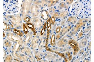 ABIN6259232 and ABIN6275659 at 1/100 staining Rat kidney tissue by IHC-P. (USP45 抗体  (Internal Region))