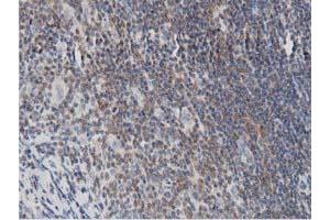 Image no. 5 for anti-DnaJ (Hsp40) Homolog, Subfamily A, Member 2 (DNAJA2) antibody (ABIN1497862)