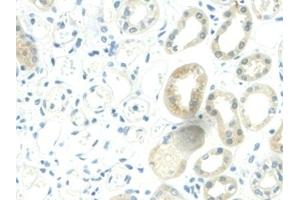 Immunohistochemistry (IHC) image for anti-Nicotinamide phosphoribosyltransferase (NAMPT) (AA 1-491) antibody (ABIN7432295)