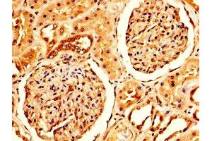 IHC image of ABIN7143857 diluted at 1:200 and staining in paraffin-embedded human kidney tissue performed on a Leica BondTM system.