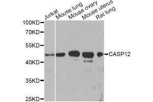 Western blot analysis of extracts of various cell lines, using CASP12 Antibody. (Caspase 12 抗体)