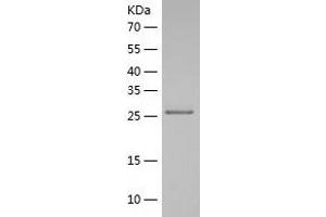 Western Blotting (WB) image for Polyglutamine Binding Protein 1 (PQBP1) (AA 1-265) protein (His tag) (ABIN7284548) (PQBP1 Protein (AA 1-265) (His tag))
