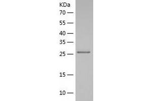 PQBP1 Protein (AA 1-265) (His tag)