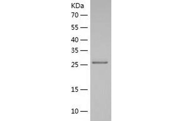 PQBP1 Protein (AA 1-265) (His tag)