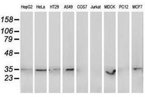 Image no. 2 for anti-Retinol Dehydrogenase 14 (All-Trans/9-Cis/11-Cis) (RDH14) antibody (ABIN1500657) (RDH14 抗体)