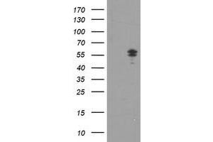 HEK293T cells were transfected with the pCMV6-ENTRY control (Left lane) or pCMV6-ENTRY NONO (Right lane) cDNA for 48 hrs and lysed. (NONO 抗体  (AA 184-385))
