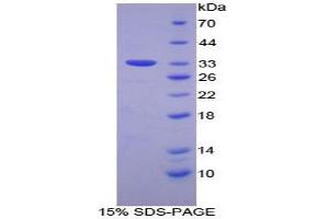 SDS-PAGE analysis of Human FOS Like Antigen 1 Protein. (FOSL1 蛋白)